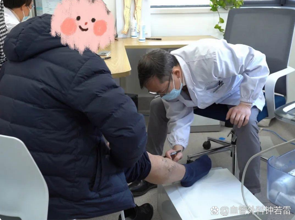 从上海到武汉治静脉曲张值不值？69岁大叔微创术后就医记录，令人动容！