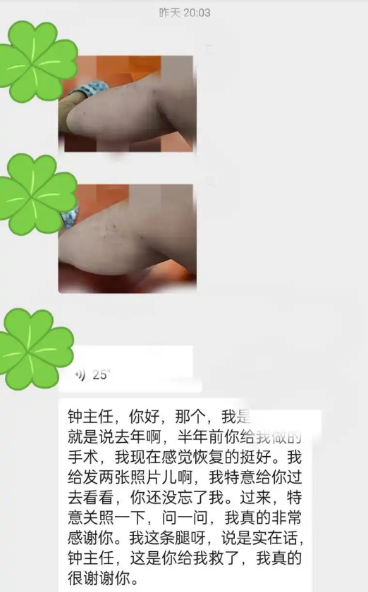 62岁静脉曲张，独自去武汉做微创，术后半年坦言：大老远没白来！