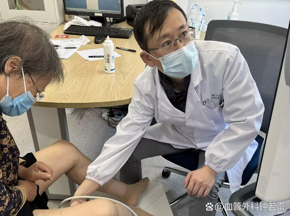 65岁阿姨静脉曲张腿沉抽筋，担心老了给子女添麻烦，下定决心微创治疗