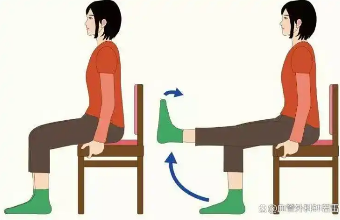 预防静脉曲张，记住这3句话！