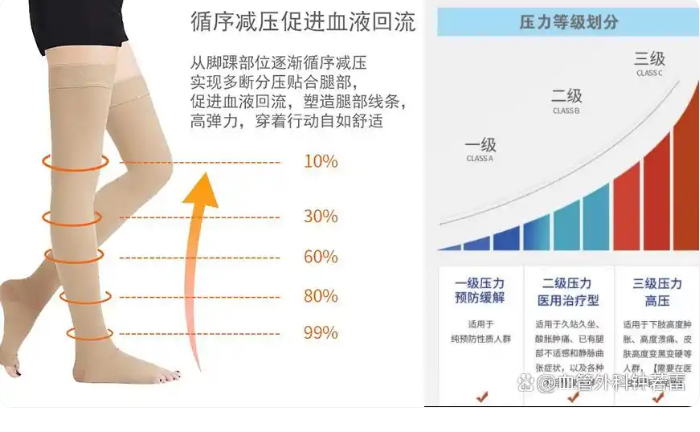 预防静脉曲张，记住这3句话！