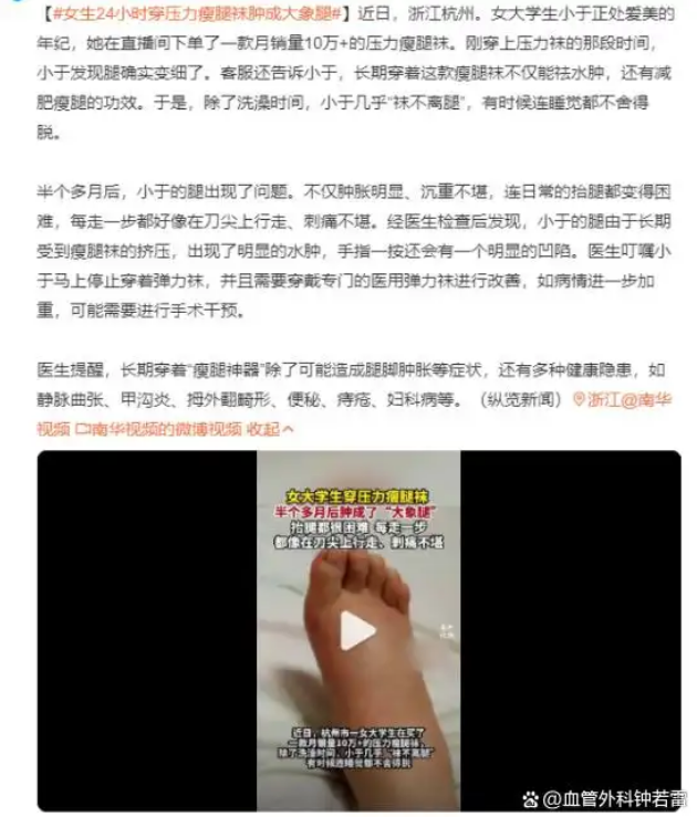 静脉曲张很少有医生愿意说，但很现实的3个问题