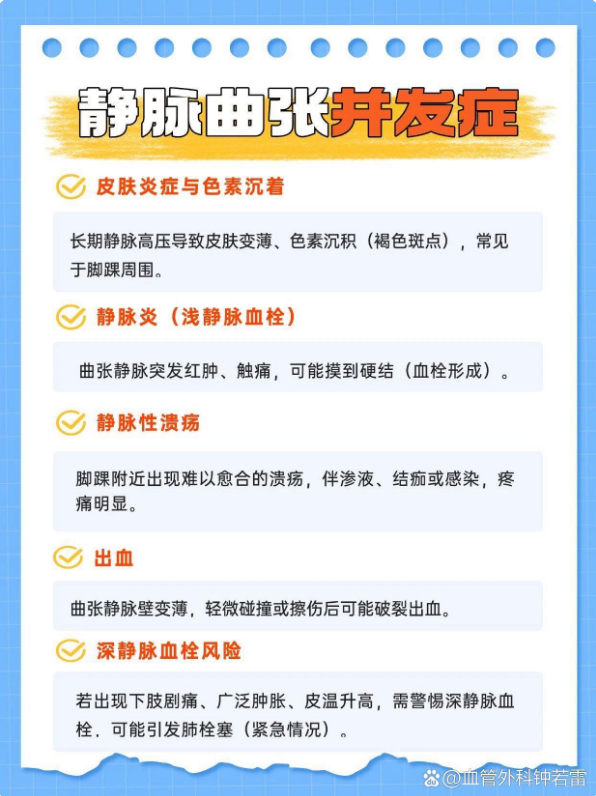 久站久坐腿酸胀到不行，究竟是哪里出了问题？