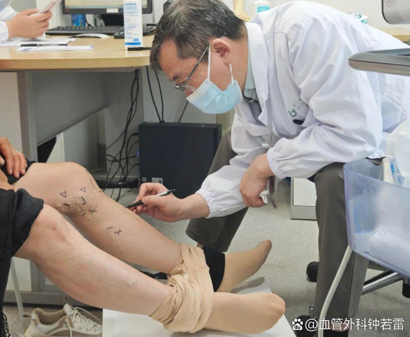 静脉曲张不是 “腿上长青筋” 这么简单，这3个要命误区正在掏空你的血管