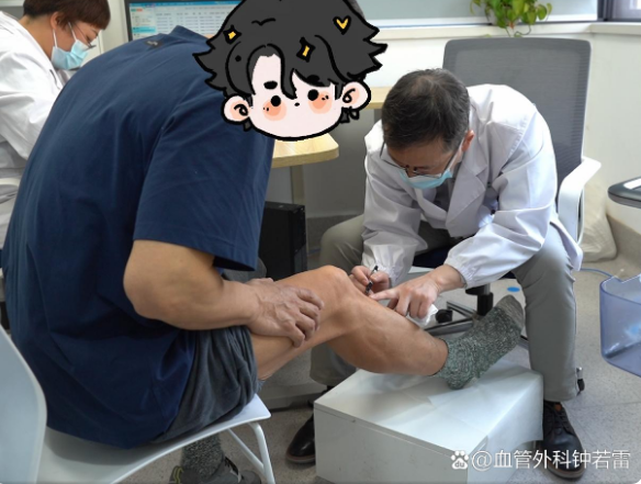 吉林55岁大哥，26小时火车，只为到武汉做静脉曲张微创！