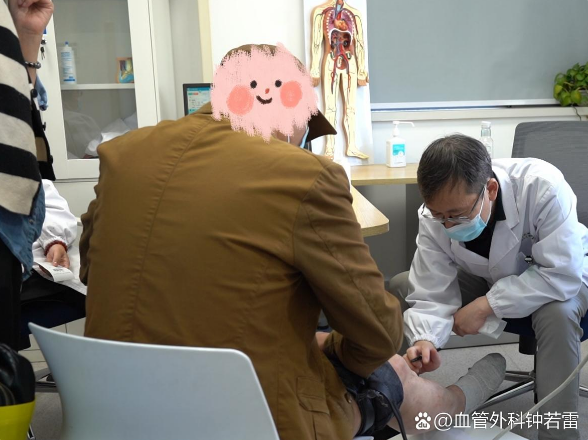 56岁厨师静脉曲张，腿痒抽筋吃药不管用，女儿逼着来微创