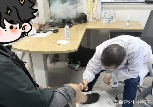 62岁静脉曲张，腿上血管像“大地图”，害怕以后烂腿去做微创，分享自己的感受