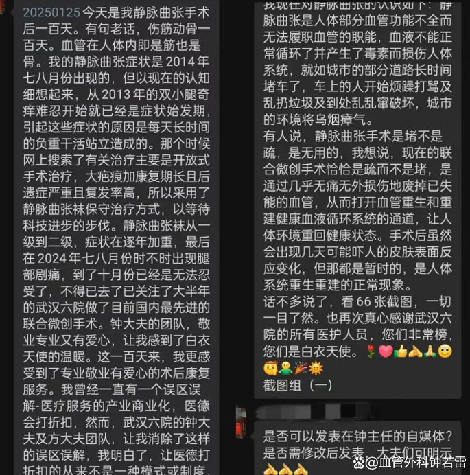 静脉曲张微创术后100天，决定公布一些真相，只有过来人才知道！