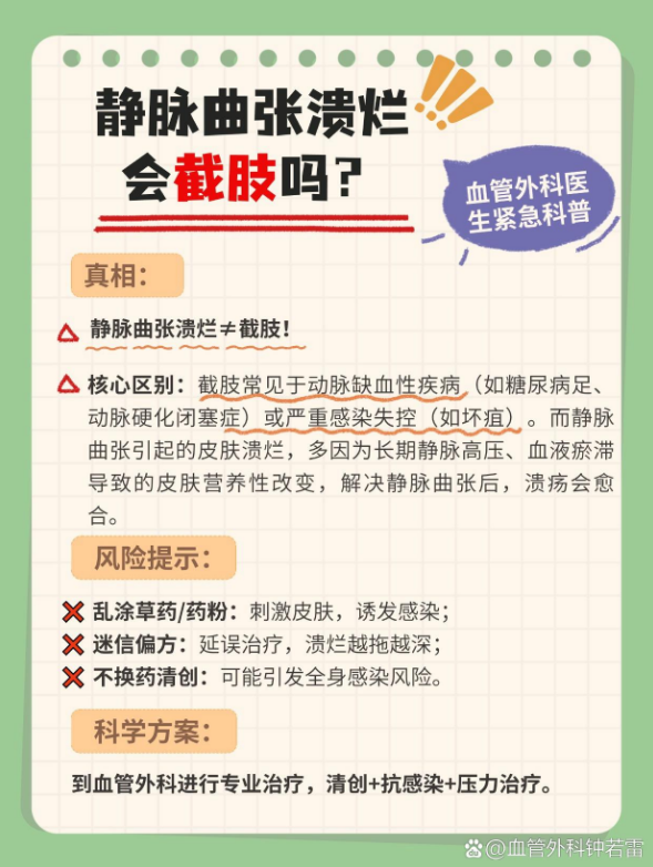 	
静脉曲张溃烂会截肢吗?
