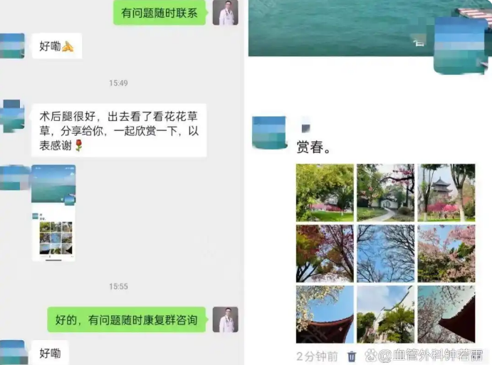 52岁大姐静脉曲张逆袭之旅，除了保持2个习惯，还与这个意识有关