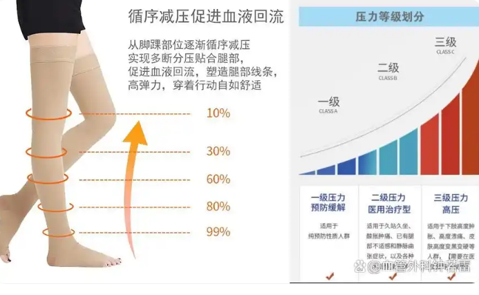52岁大姐静脉曲张逆袭之旅，除了保持2个习惯，还与这个意识有关